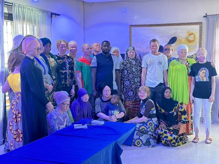 L'association des femmes albinos du Burkina 